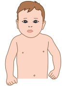 signes de la brconchiolite