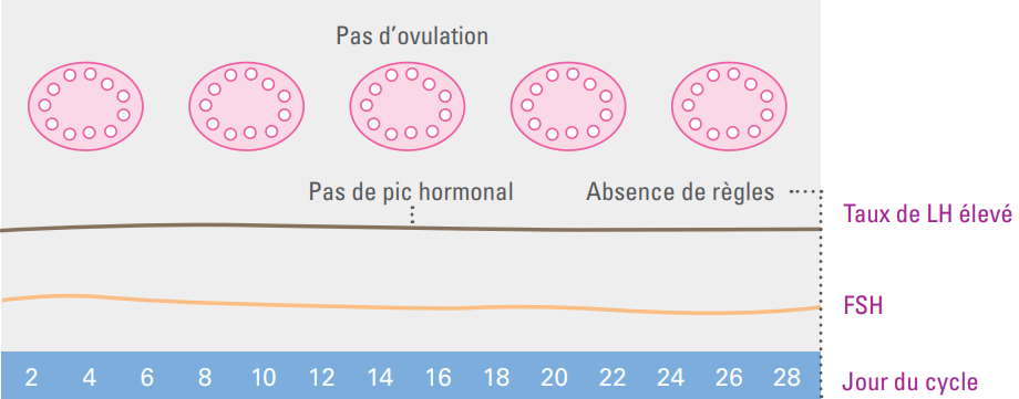 règles avec SOPK