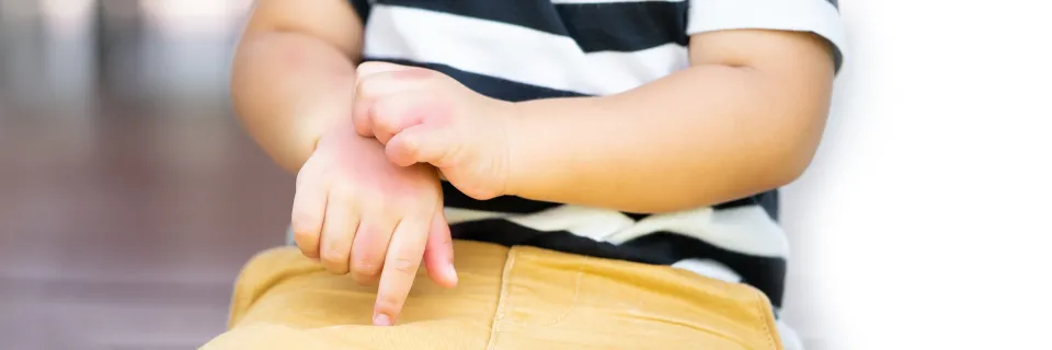 enfant dermatologie rougeur